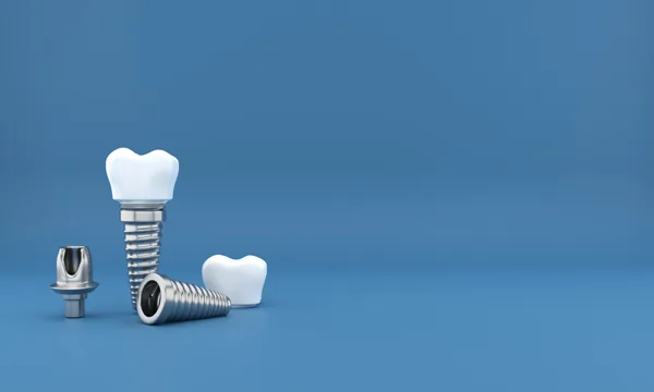 implants-dr-sebastian-fotescu-zahnarztpraxis-dresden-webp