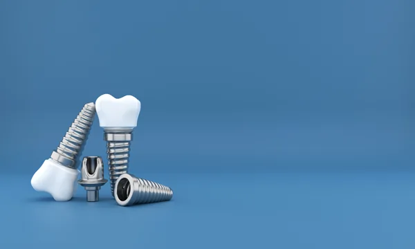 implants-dr-sebastian-fotescu-zahnarztpraxis-dresden-webp